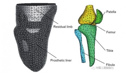 增材制造技術(shù) 假肢與矯形器領(lǐng)域的個(gè)性化革新
