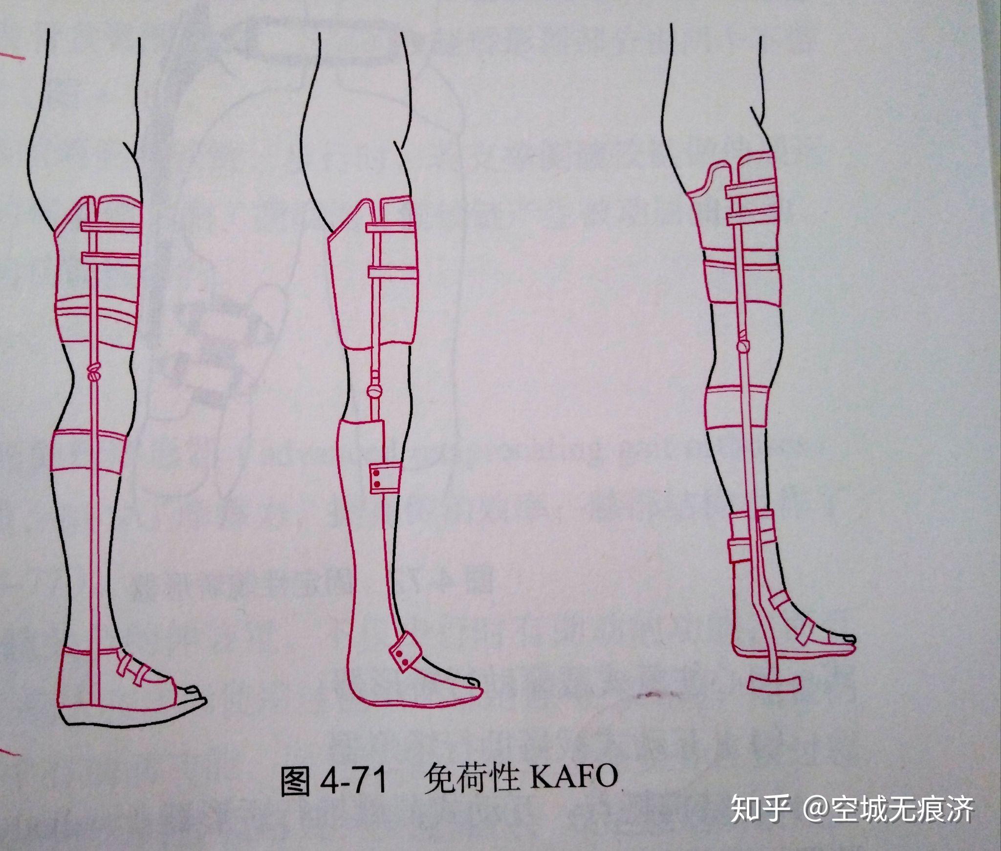 臨床康復(fù)工程學(xué) 假肢與矯形器的功能、設(shè)計與發(fā)展